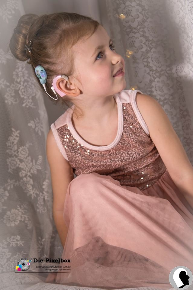 CI Kopf 2018 weiblich Kind